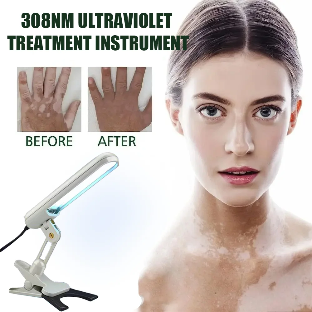 УФ-лазерная лампа для фототерапии борьбы с витилиго псориазом белой пяткой