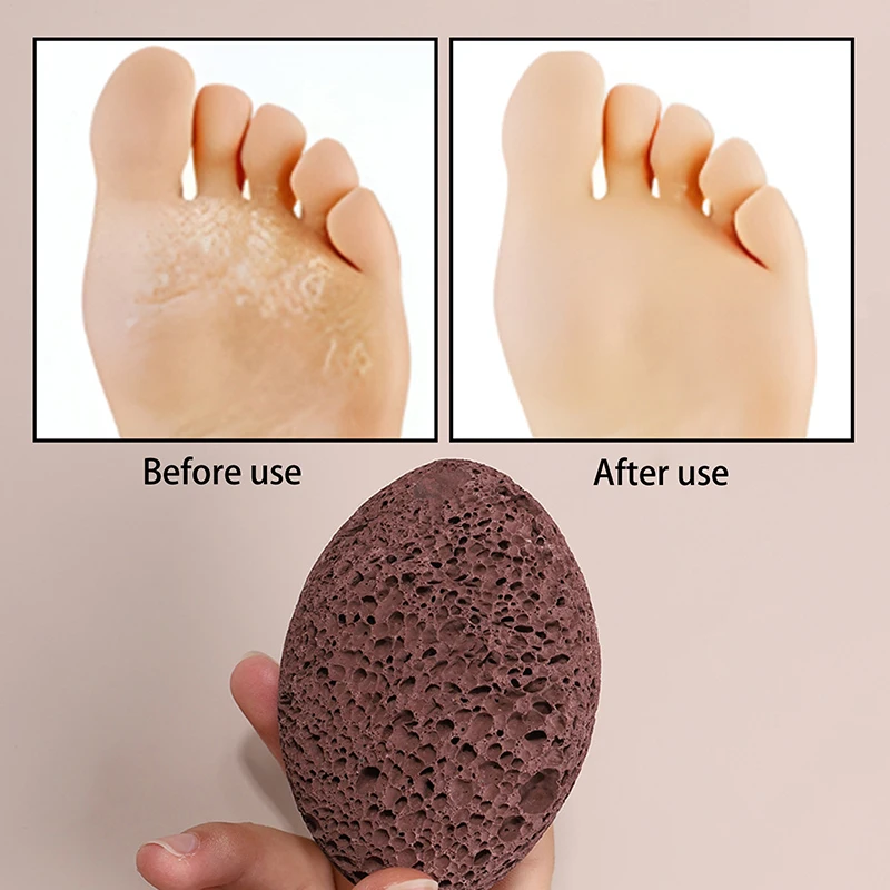Пемза скребок для камней пилка ног отшелушивающая педикюр уход за мертвой и