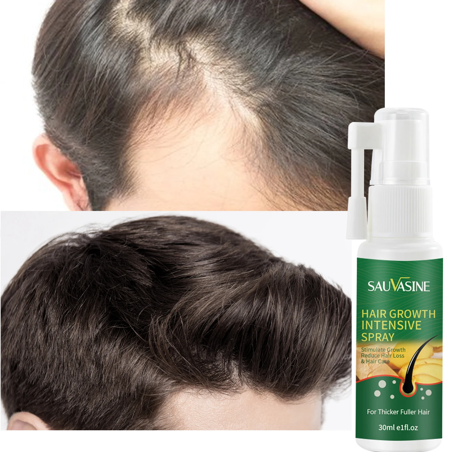 

Новый имбирный спрей для роста волос, необходимый спрей, сыворотка против выпадения волос, эффективный Восстанавливающий растущий Уход за ...