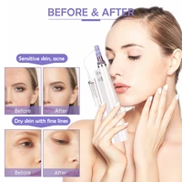 water mesotherapy injector hydrolifting device high pressure wrinkle removal face lifting tighten skin deep hydration care tool