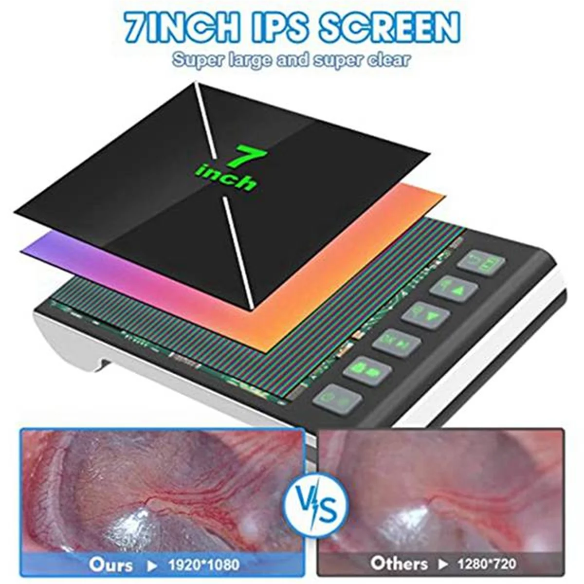 Цифровой отоскоп с 7-дюймовым экраном ушной камерой визуальной насадкой для ушей