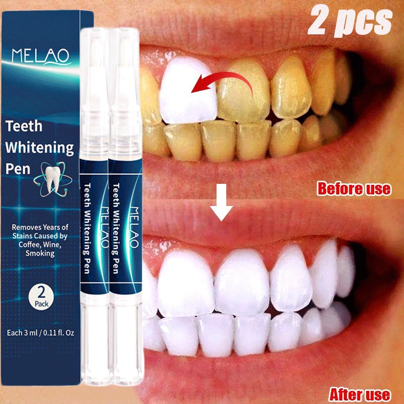 2 PCS Teeth Whitening Gel Pen Removes Breath Freshen Oral Hygiene Care Remove Plaque Stains Cleaning Essence Gel Toothpaste