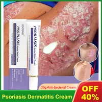 herbal psoriasis dermatitis cream effective antibacterial anti itch relief eczema body ointment urticaria desquamation skin care