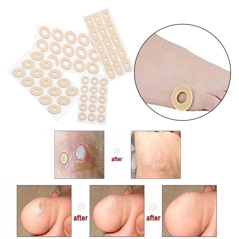 

Anti-callus Foot Patch Latex Soft Foam Corns Patch High Heel Feet Pads Pain Foot Corns Bunion Protectors Pads Feet Treatment