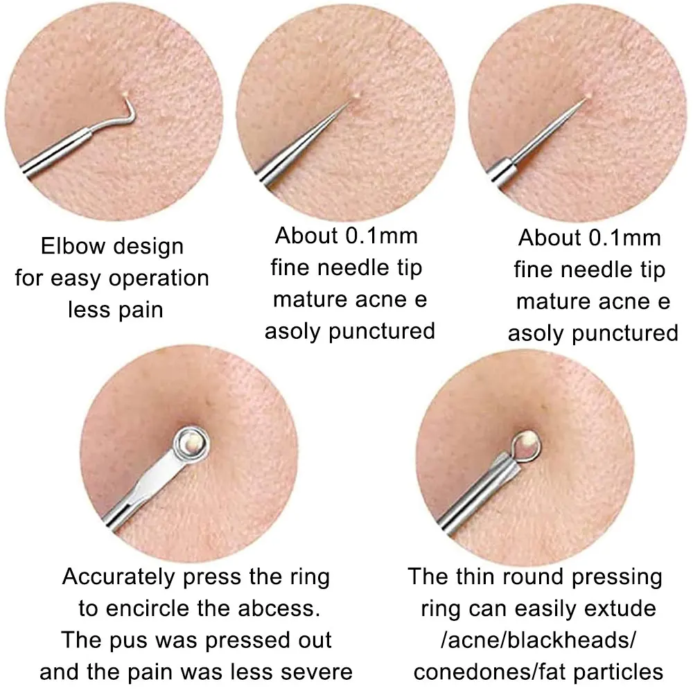 4 шт. иглы для удаления чёрных точек на лице |