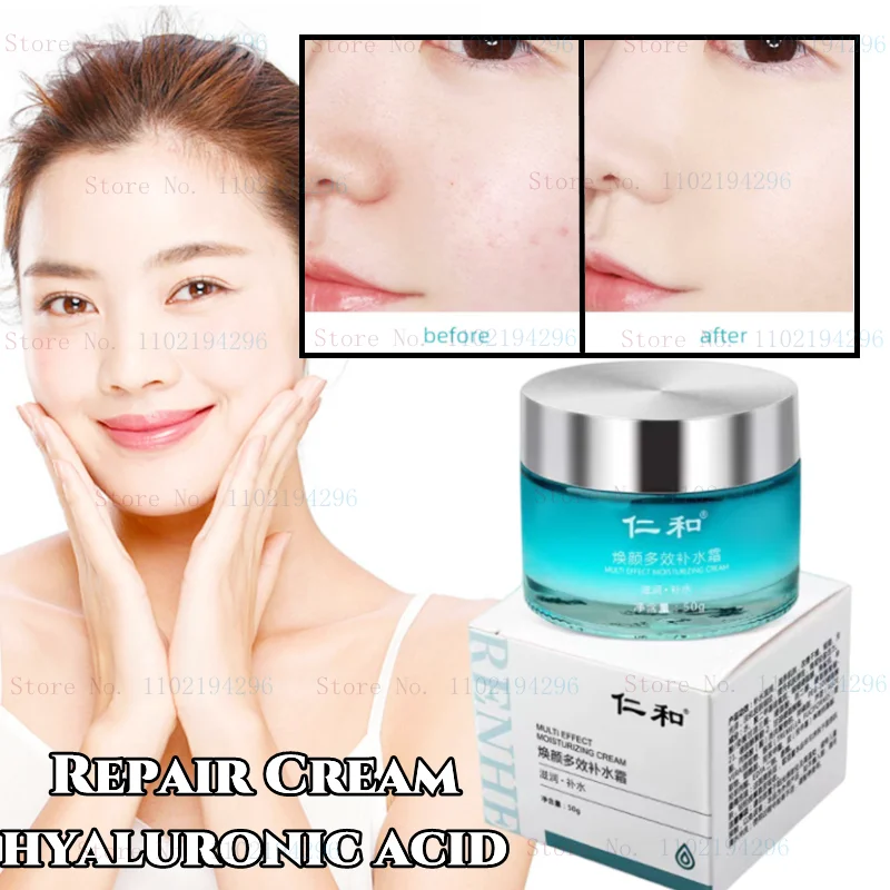 

High Moisturizing Cream Winter Hydrating Cream Hyaluronic Acid Mild Repair Cream Nourishing and Hydrating To Improve Dry Peeling