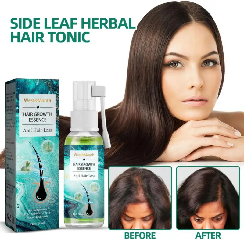 

Спрей Herbals для роста волос с эфирным маслом, средство для лечения выпадения волос, средство для предотвращения высыхания волос, истончение и восстановление волос, 60 мл