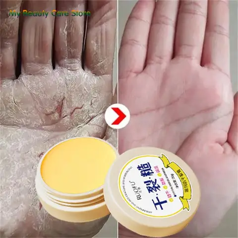 Антивозрастной крем для ног с трещинами, восстанавливающий крем для пятки с трещинами, Антивозрастная фотомаска для пятки, удаление мозолей, отбеливание - изображение