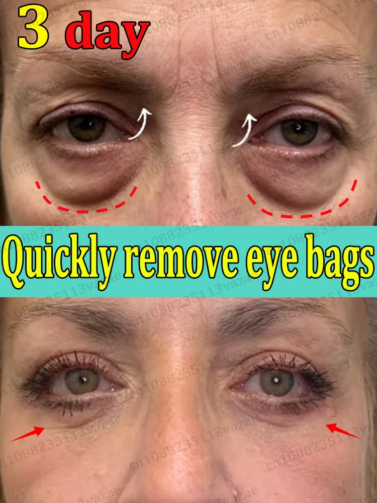 

POZOAMIS Eye Serum