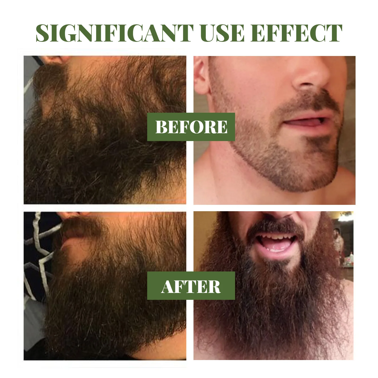 Hairy Man Care: Beard Products Australia
