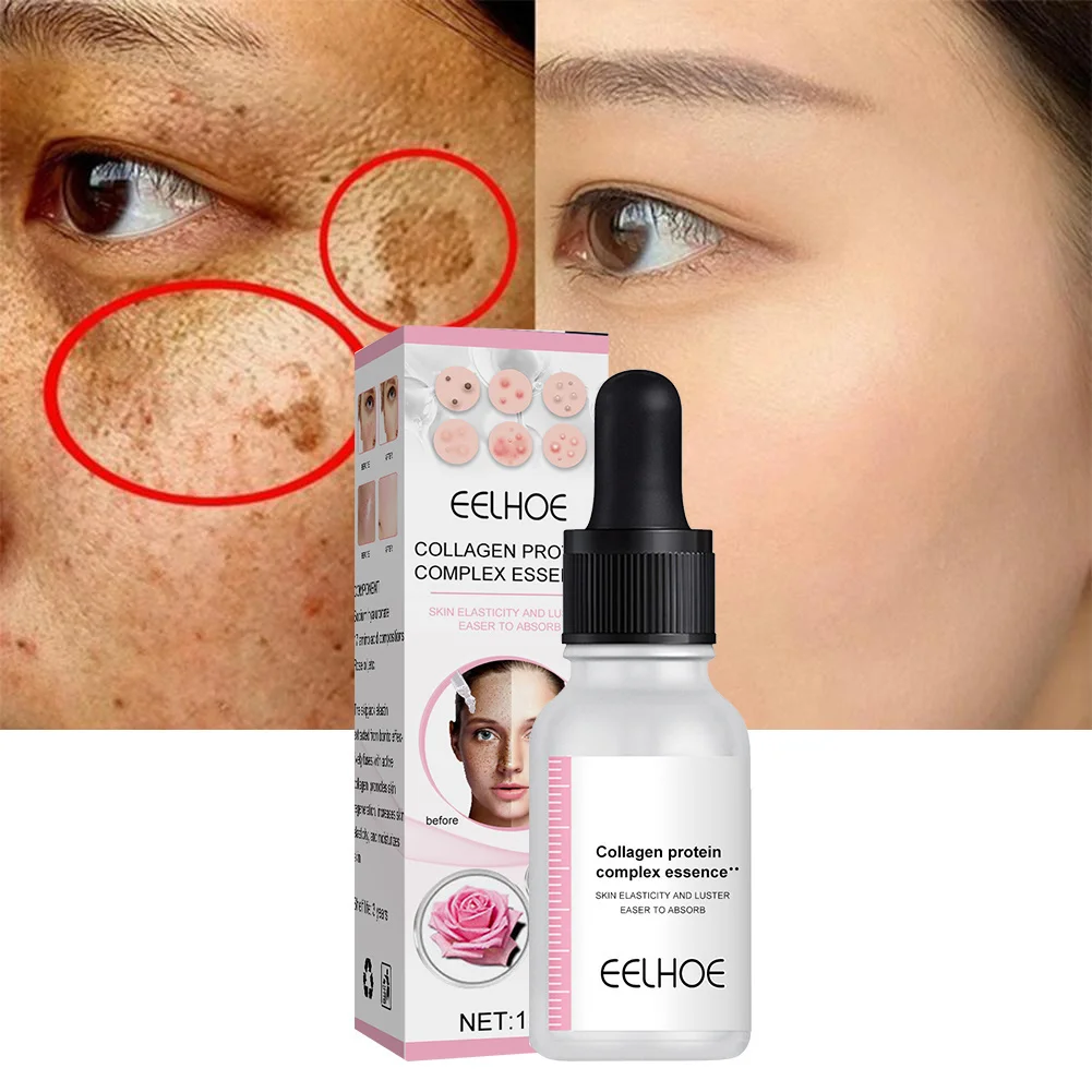 Collagen Whitening Freckles Face Serum Remove Melasma Dark Spots Lightening Melanin Moisturizing Brightening Skin Care Products