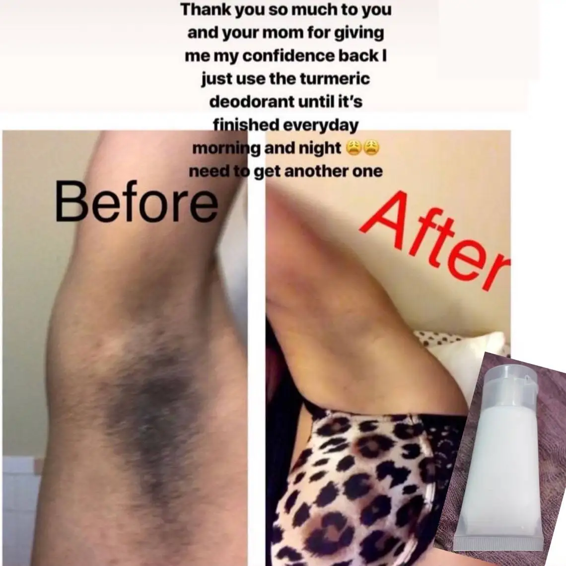 

Lightening Cream Moisturizing Nourish Repair Improve Arm Armpit Ankles Elbow Knee Body Dull Brighten Arbutin Turmeric Skin Care