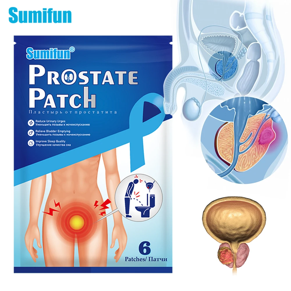 

6pcs Prostate Navel Patch Man Urethritis Urologic Prostatitis Treatment Medical Plaster Urinary Pain Relief Sticker Health Care