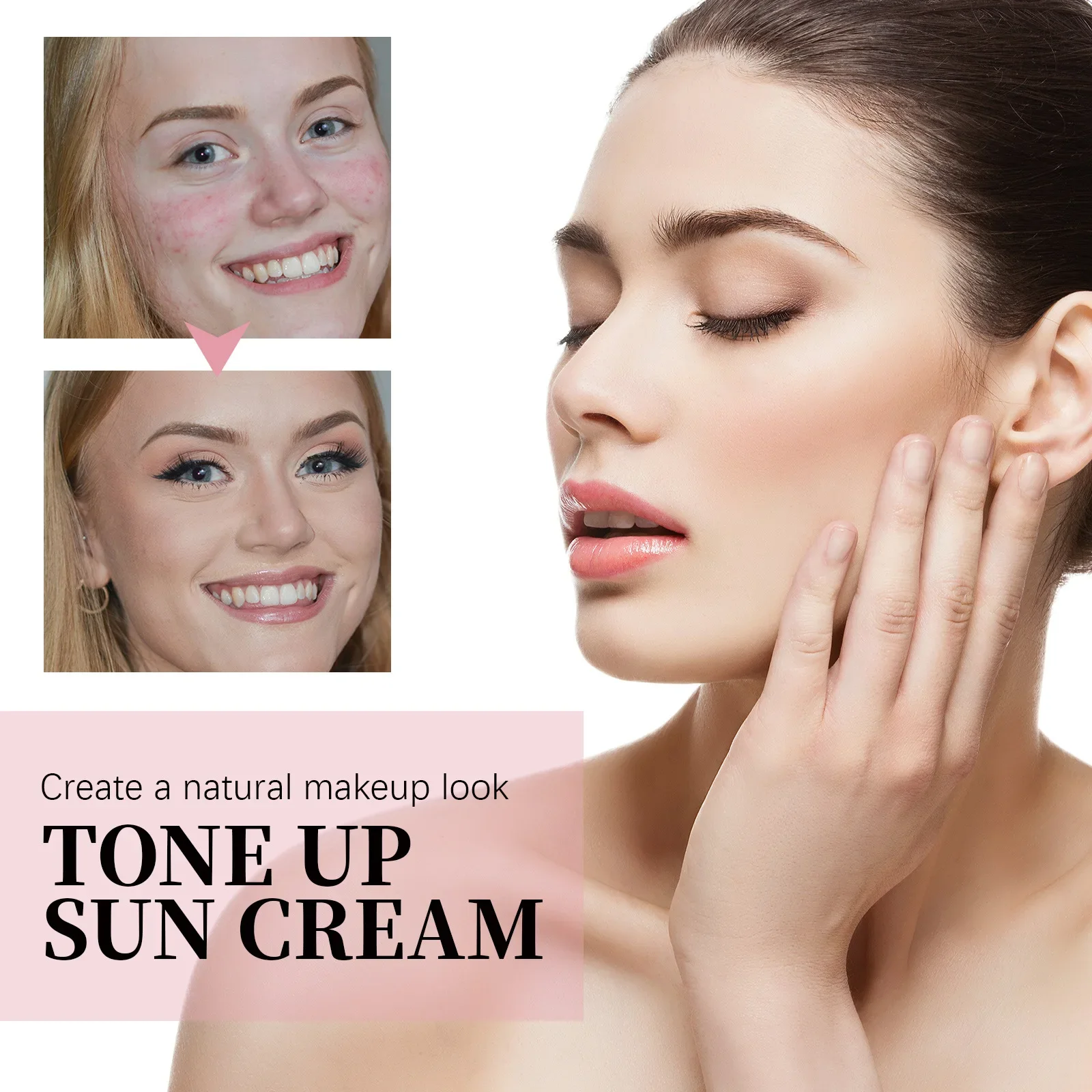 Рекомендуется увлажняющий и нежирный отбеливающий крем с защитой от УФ-лучей