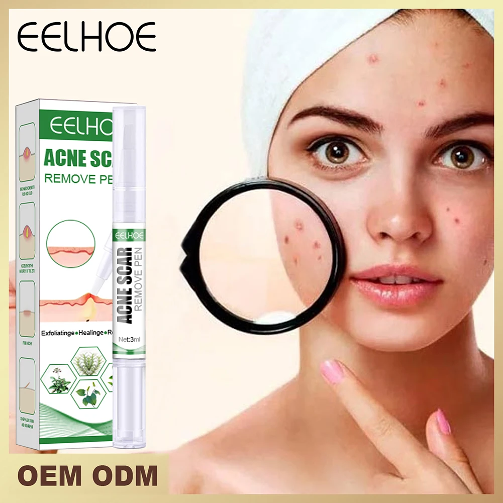 

Эффективное средство для удаления акне, освежающее пятна от акне, крем для жирной кожи, отбеливающий увлажняющий гель для лица, уход за коже...