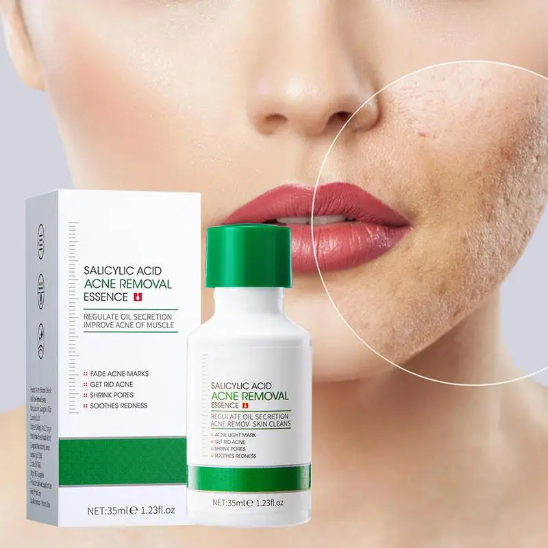 

Salicylic Acid Face Serum Shrink Pore Moisturizing Essence 35ml Improve Acne Blackheads Oil Control Hydrating Cream Skin Care