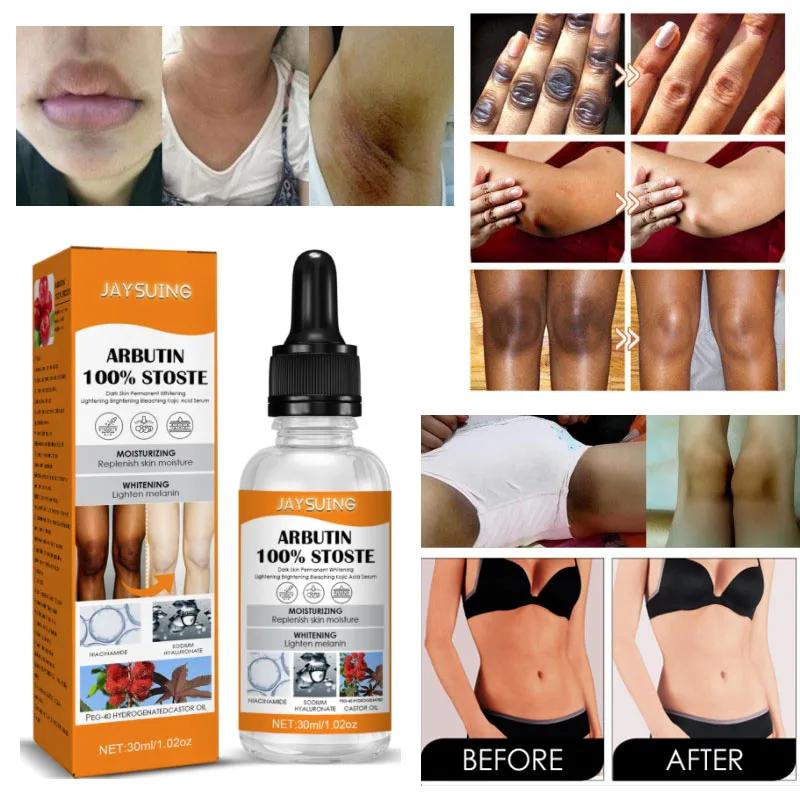

Отбеливающая сыворотка Niacinamide для подмышек, суставов колена, ягодиц, частный отбеливатель для тела, увлажняющий крем для улучшения меланина...