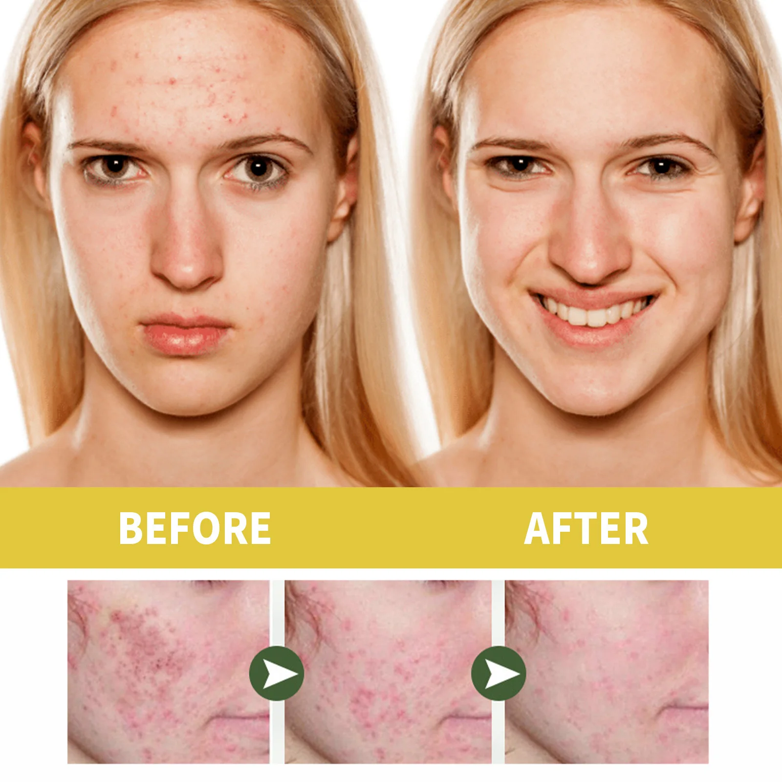 Рекомендовано Jaysuing эфирное масло для орхидеи очищение осветление угрей