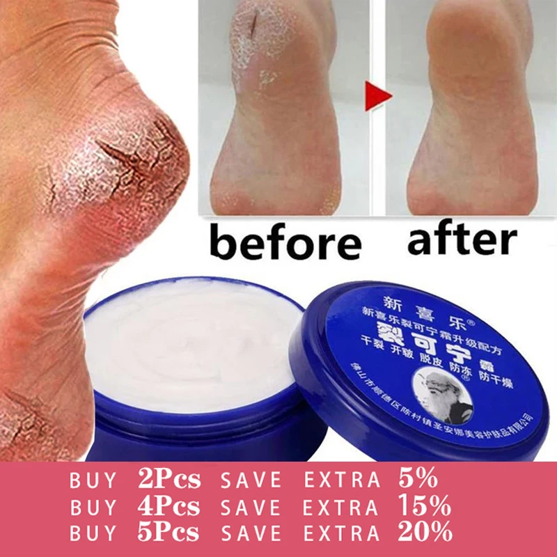 10 дней, травяной крем для ног против трещин, антивозрастной крем для ног, антивозрастной крем для удаления пятки и трещин, восстанавливающий крем для удаления омертвевшей кожи, уход за кожей рук и ног