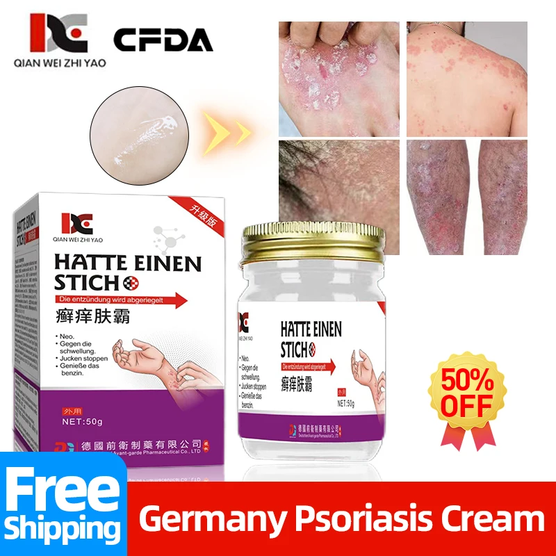 

Germany Psoriasis Treatment Ointment Eczema Skin Pruritus Repair Cream Dermatitis Fungus Anti-Itch Natural Herbal Medicine