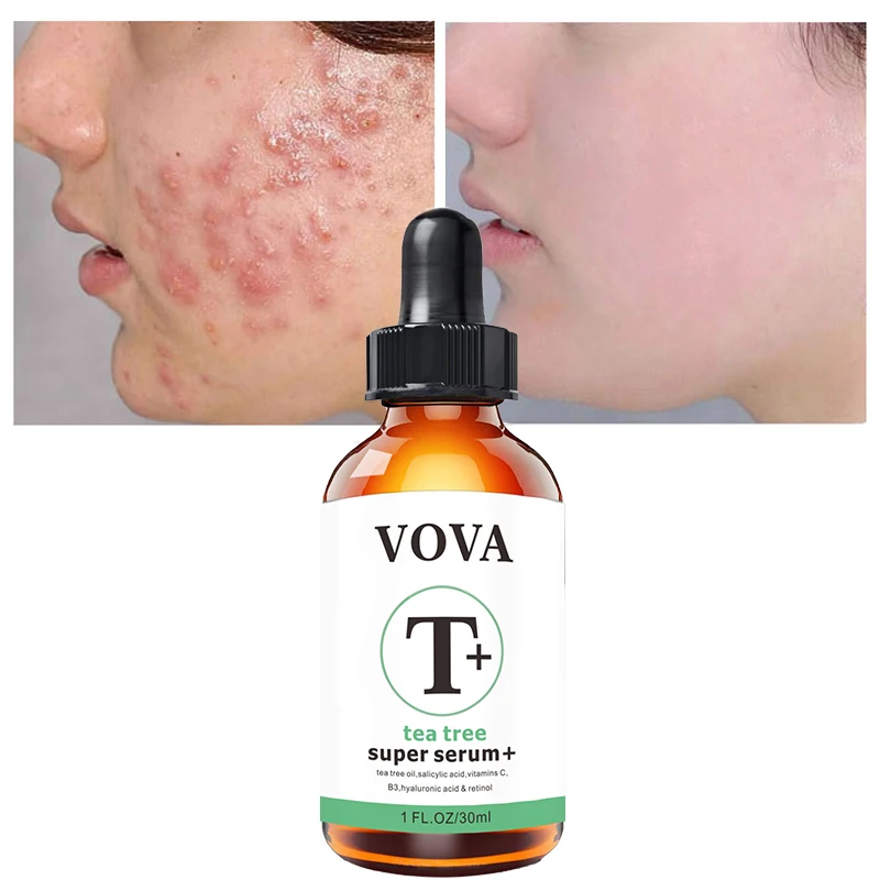 

Tea Tree Essential Oil Anti-wrinkle Extract Acne Removal Scars Treatment Massage Oils Organic