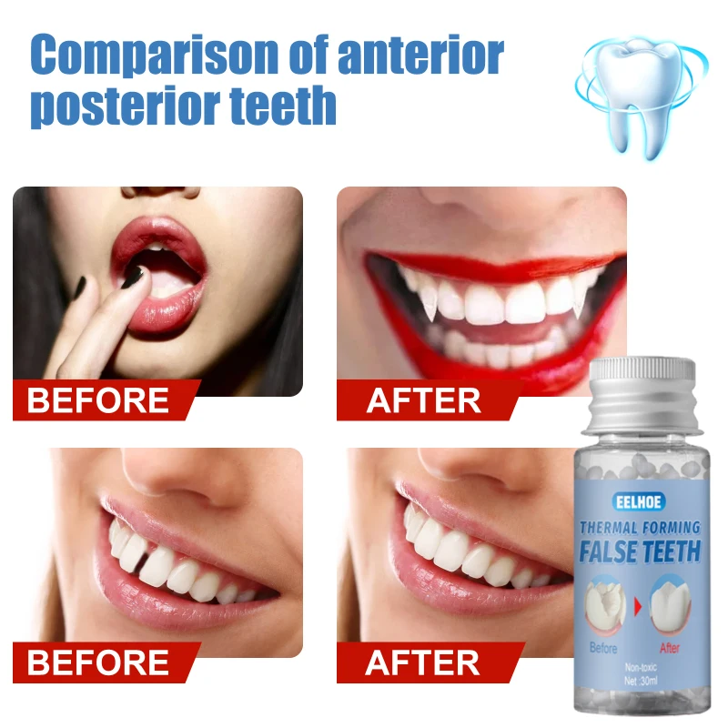

Solid Dental Glue Bottled Teeth Whitening Artificial Teeth Modification Falseteeth Teeth Solid Glue Bottled Teeth Whitening Fill