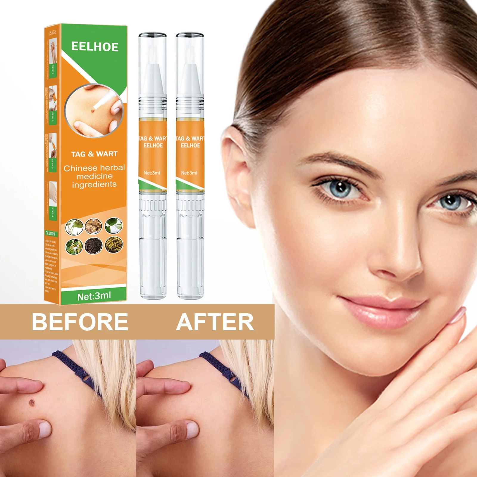 

Искусственная кожа, бородавки, ярлыки, этикетки для удаления темных точек кожи, жидкость для лица и тела, оздоровительные кроты