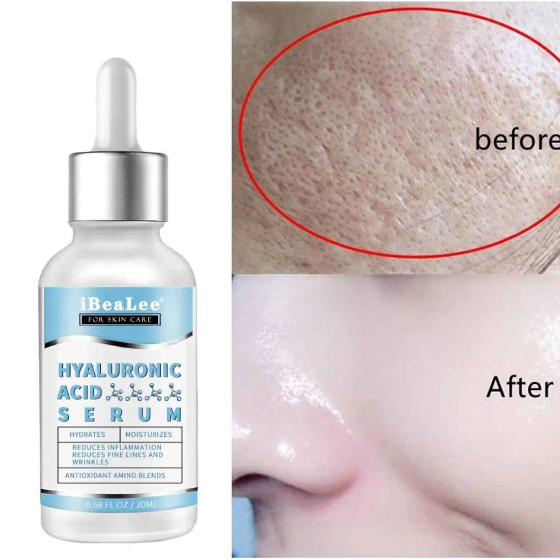 

Pore Shrinking Face Serum Firming Brighten Niacinamide Whitening Remover Dark Spot Freckle Hyaluronic Acid Moisturizer Skin Care
