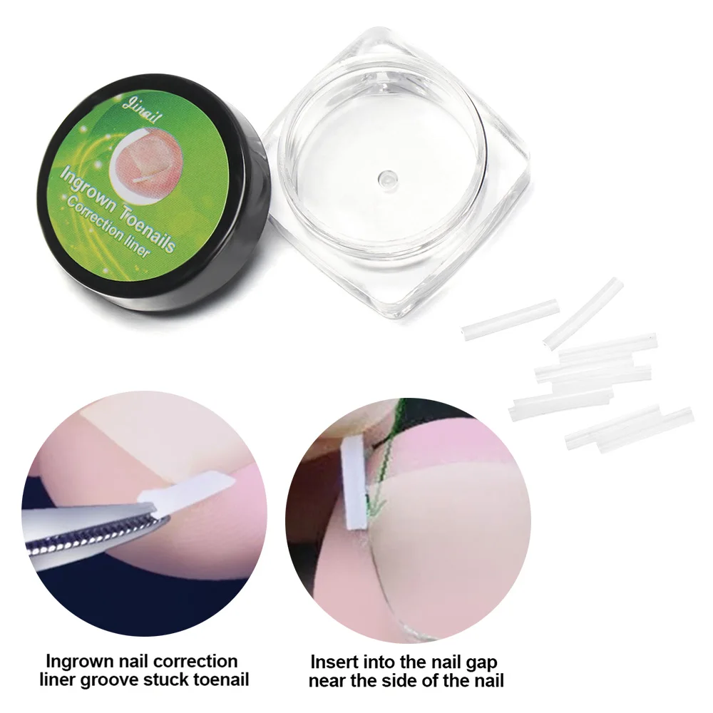 

Foot Care Tool Prevent allergy Correction Wire Flexible Ingrown Nail Pads Artifact Nail Groove Pad Nail Corrector