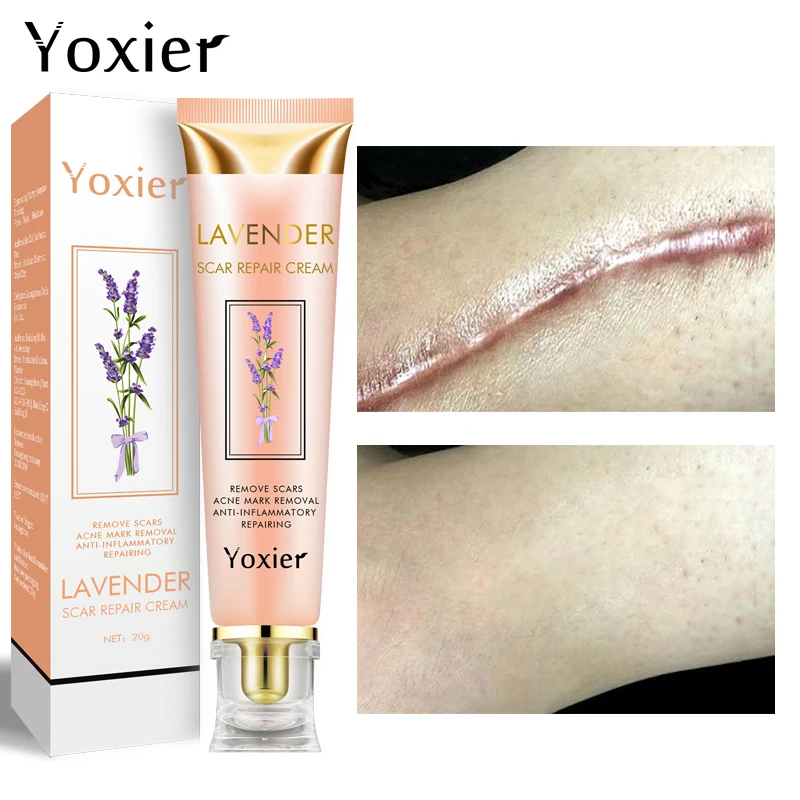 Yoxier Lavender Acne Scar Removal Cream Gel Face Pimples Stretch Marks Repairing Smoothing Pigmentation Corrector Whitening Care