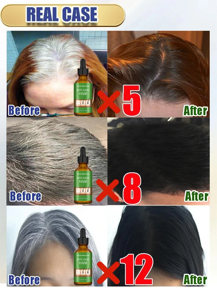 Suero Natural Anti gris para el cabello reparación de blanco y oscurecimiento remedio nutritivo cuidado del
