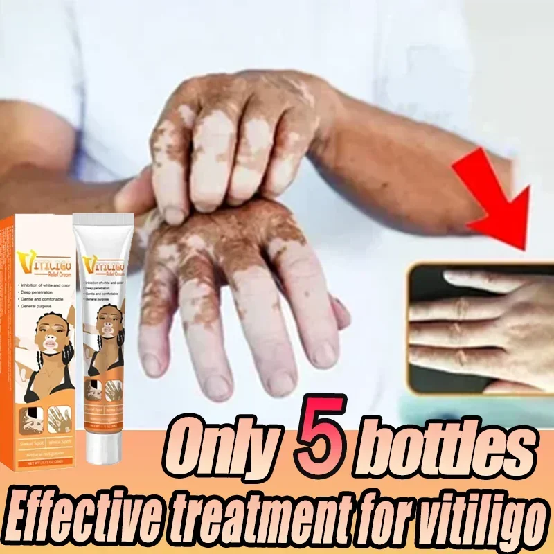 Крем от белых пятен псориаза витилиго антибактериальный бактериостатический