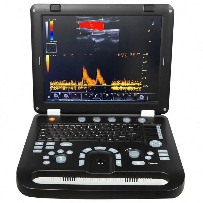 

Wh-29 Siterite Vascular Ultrasound Ultrasonic For Sale