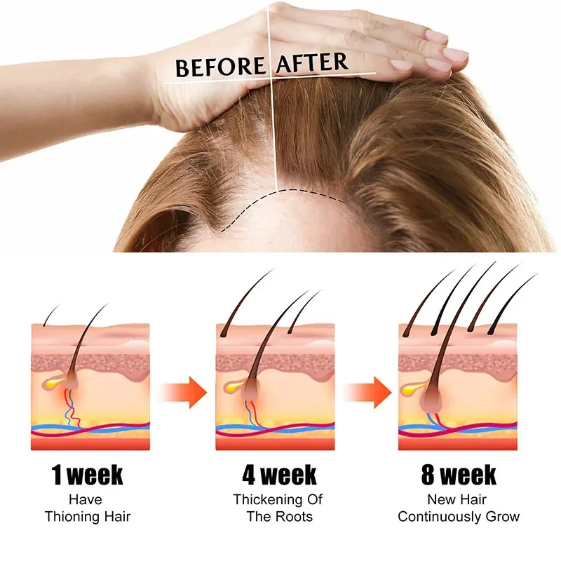 Быстрое масло Африка Безумное тяговое выпадение волос эссенция анти - густая