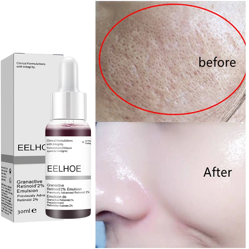

30ML Salicylic Acid Shrink Pores Serum Gental Exfoliating Moisturize Nourish Smooth Facial Repair Fade Ance Scar Essence Product