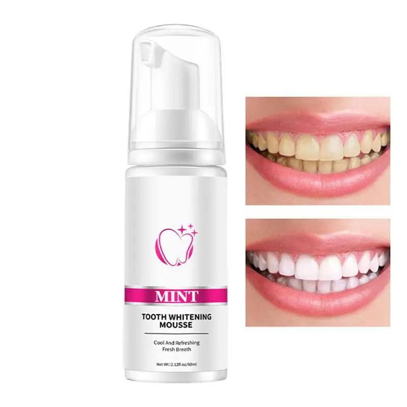 

Tooth Mousse Deep Cleaning Stain Removal Toothpaste Whitenings Toothpaste For Bad Breath Control Oral Care And Teeth Care