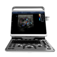 chison ebit30 4d 5d portable color doppler human ultrasound gynecologycardiovascular echo machine
