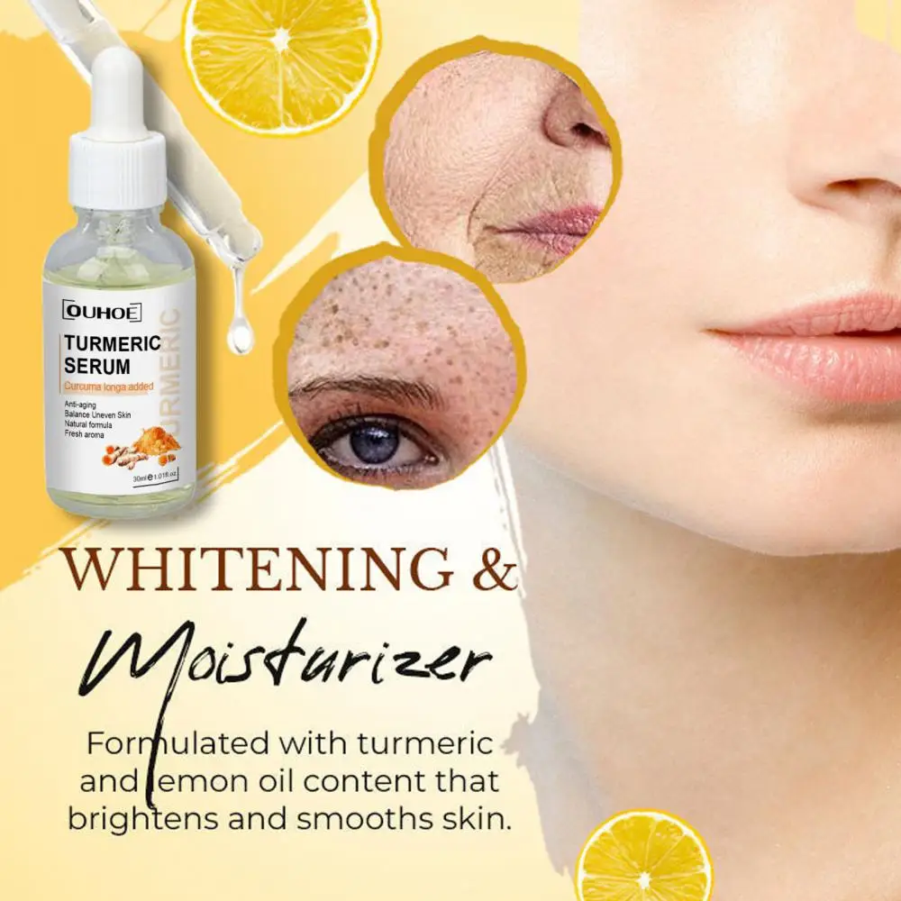 

Turmeric Freckle Whitening Serum Fade Dark Spot Remove Pigment Melanin Correcting Facial Essencet Moisturizer Face SkinCare 30ml