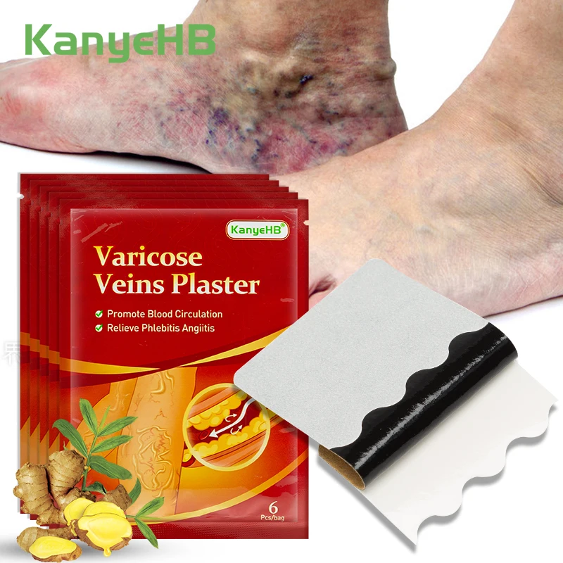 

30 шт. = 6 упаковок, пластырь от варикозного расширения вен