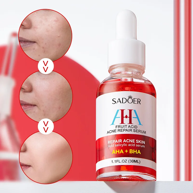 

Sadoer Acne Repair Serum Hydrates And Moisturizes Fades Acne Marks Controls Oil Anti-wrinkle Serum Skin Care