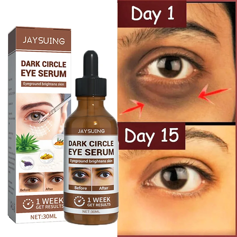 

Remove Dark Circles Eye Serum Improve Eye Bags Lifting Firming Essence Fade Fine Lines Puffiness Moisturizing Brighten Skin Care