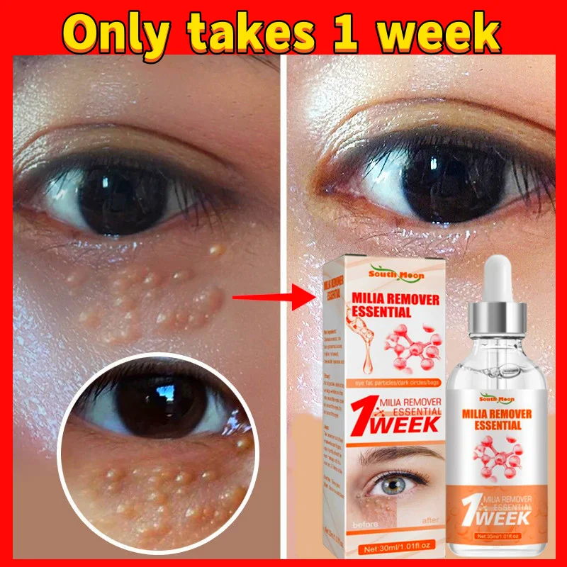 7 Days Fat Granules Remover Serum Improve Eye Bag Anti Dark Circles Moisturizing Firming Anti-Puffiness Fade Fine Lines Eye Care