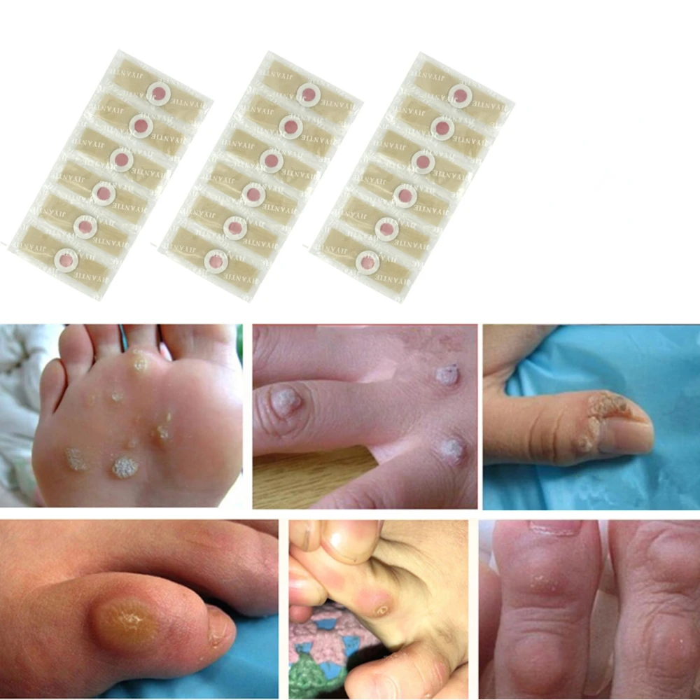 

24PCS Medical Corn Plaster Foot Corn Removal Warts Thorn Killer Plantar Calluses Callosity Patch Detox Foot Protector Sticker