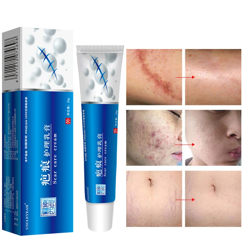 

Acne Scar Removal Cream Pimples Stretch Marks Face Gel Remove Acne Smoothing Whitening Body Skin Care Pigmentation Corrector