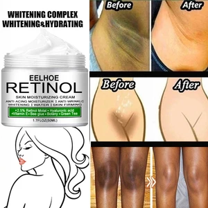 Body Whitening Cream Private Parts Underarm Bleaching Serum Whiten Butt Knee Brighten Inner Thigh In
