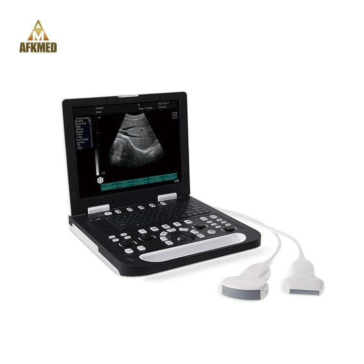 

Portable Veterinary ultrasound scanner pregnancy ultrasound machine ultrasonic