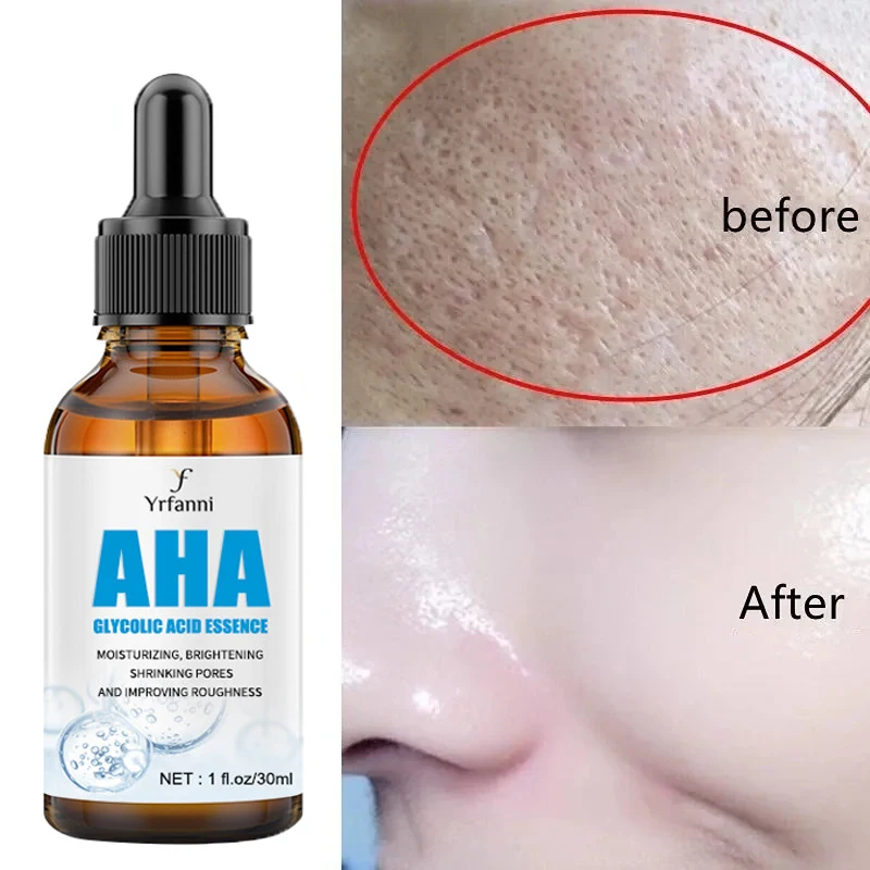 

Pore Shrinking Serum Remove Large Pores Tightening Repairing Essence Salicylic Acid Anti Acne Whitening Glowing Beauty Skin Care