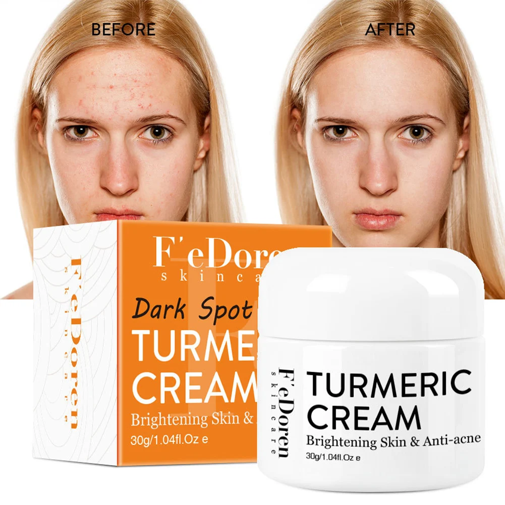 

Herb Turmeric Face Cream Repair Acne Scar Dark Spot Treatment Moisturizer Whitening Lighten Brightening Anti-Acne Skin Care 30ml