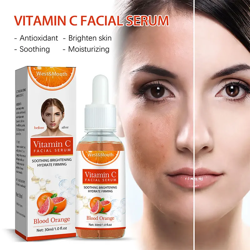 

30ml Vitamin C Face Serum Care Whitening Lighten Spots Facial Skin Essence Fade Dark Spots Remove Freckle Skin Care Products