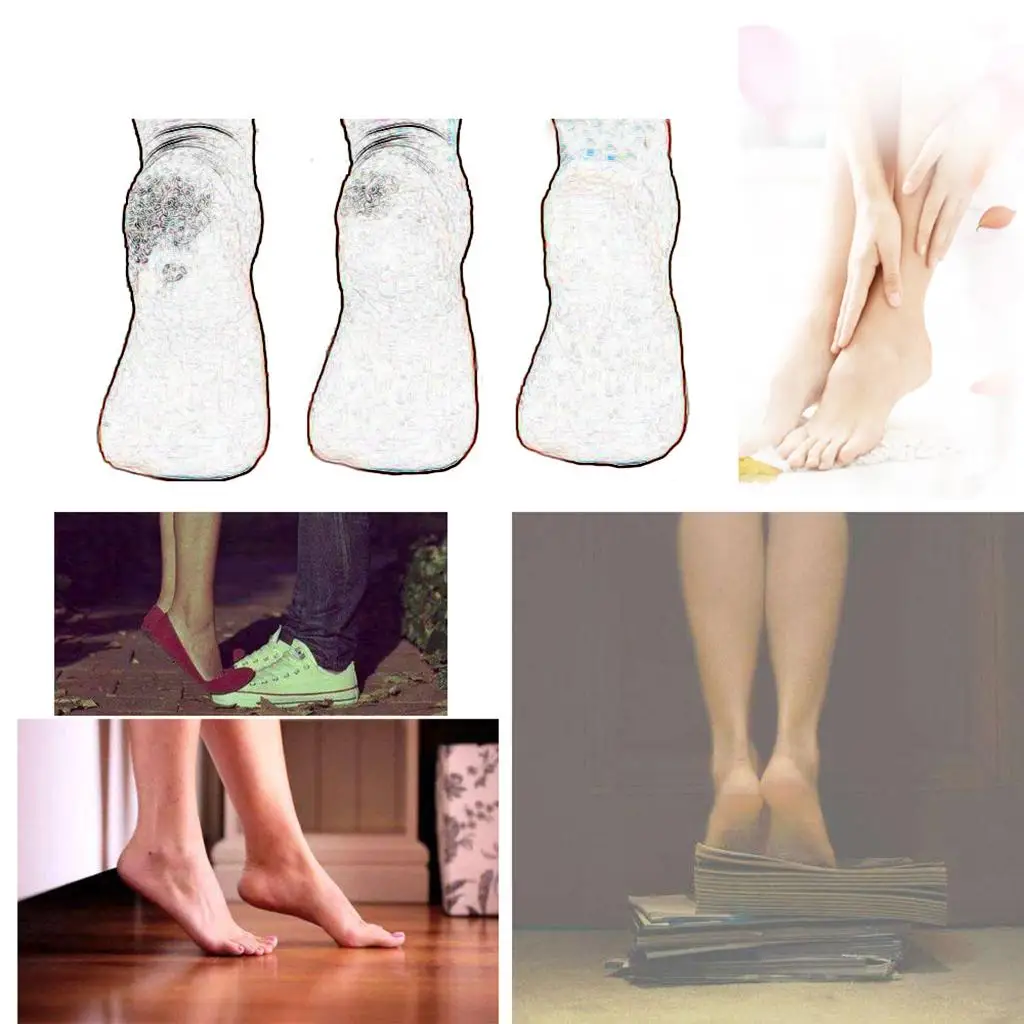 

Double Sided Foot File Skin Exfoliator Calluse Corns Remover Pedicure